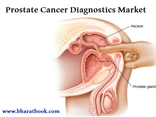 -Prostate Cancer Diagnostics Market